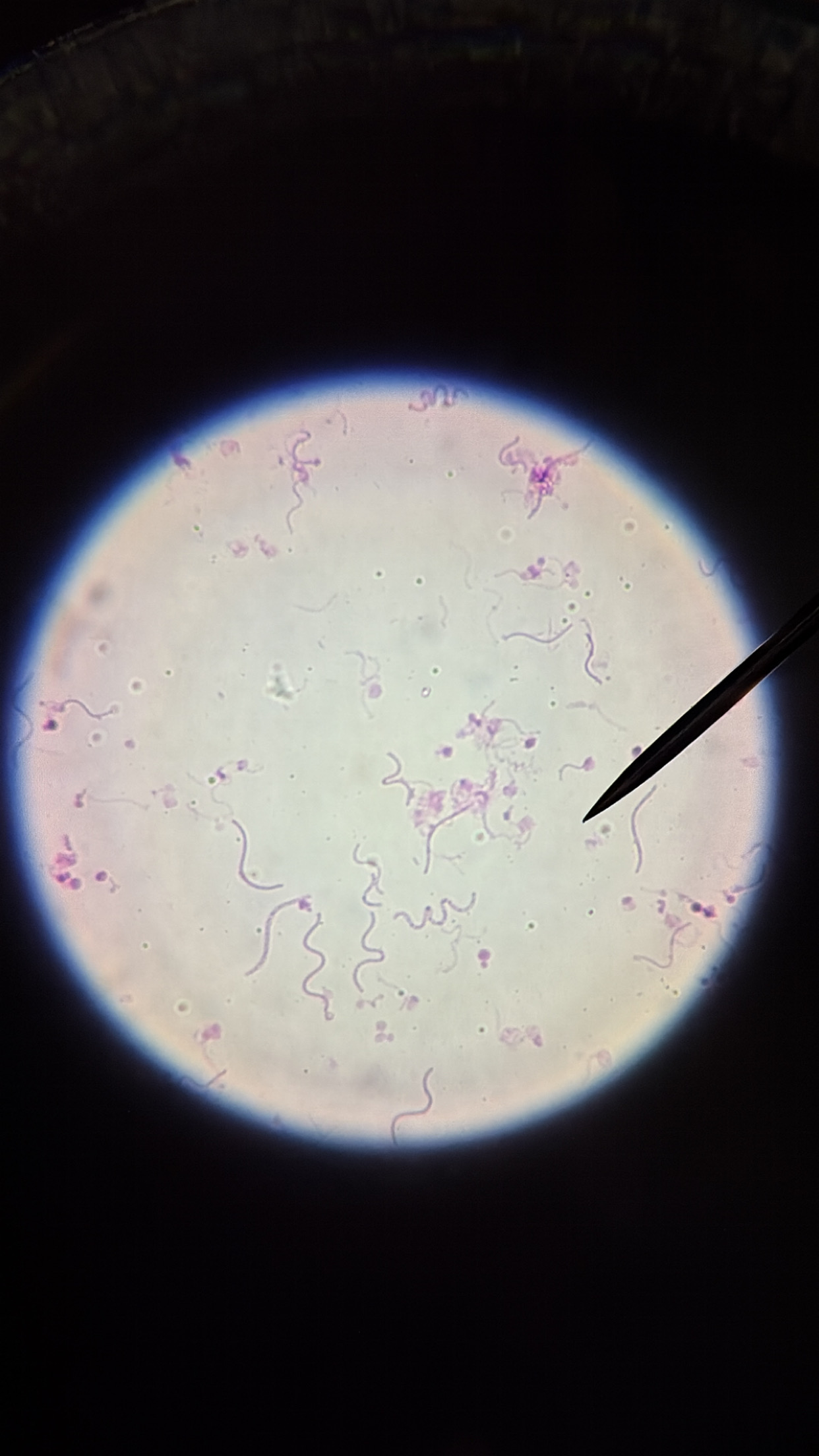 <ol><li><p>This slide shows a/an:</p></li></ol><p class="p1">a) Prokaryotic cell</p><p class="p1">b) Eukaryotic cell</p><p class="p1">c) None of the above</p><ol start="2"><li><p class="p1">Which type of cells does this slide show?</p><p class="p1">a) Cocci cells</p><p class="p1">b) Bacilli cells</p><p class="p1">c) Spirilli cells</p><p class="p1">d) None of the above</p></li></ol><ol start="3"><li><p class="p1">Which type of cell does this slide show an example of:</p></li></ol><p class="p1">a) Spirogyra</p><p class="p1">b) Volvox</p><p class="p1">c) Diatoms</p><p class="p1">d) None of the above</p><ol start="4"><li><p class="p1">Which type of cell does this slide show an example of:</p><p class="p1">a) Amoeba</p><p class="p1">b) Paramecium</p><p class="p1">c) None of the above</p></li><li><p class="p1">Which type of cell does this slide show an example of:</p><p class="p1">a) Archaebacteria or Eubacteria</p><p class="p1">b) Plantae</p><p class="p1">c) Protista</p><p class="p1">d) Fungi</p><p class="p1">e) Animalia</p></li></ol><p class="p1"></p><p class="p1"></p>