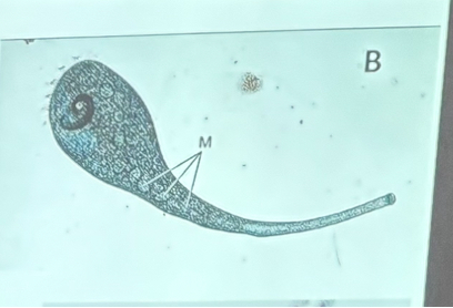 <p>What is this organism?</p>