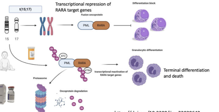 <ul><li><p>Caused by <strong>t(15;17) translocation</strong> → fusion of <strong>PML + RARA genes</strong></p></li><li><p>Forms <strong>PML-RARA fusion oncoprotein</strong></p></li><li><p>Leads to <strong>transcriptional repression of RARA target genes</strong></p></li><li><p>Causes a <strong>block in differentiation</strong> (promyelocytes cannot mature)</p></li><li><p>Results in accumulation of immature cells</p></li><li><p>Associated with <strong>extremely high risk of fatal bleeding → requires immediate treatment</strong></p></li></ul><p></p>