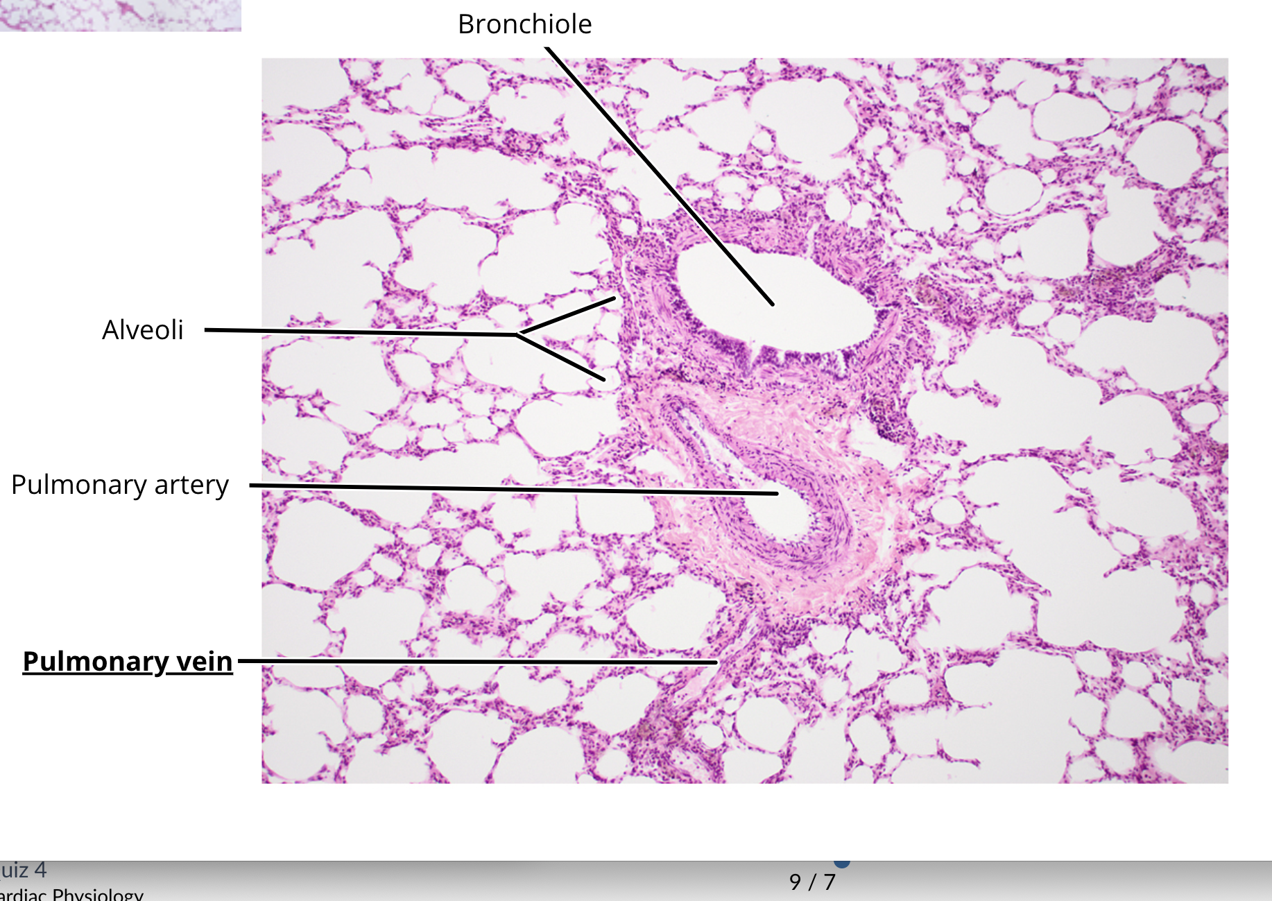 <ul><li><p>bronchi</p></li><li><p>bronchiole</p></li><li><p>alveoli </p></li></ul><p></p>