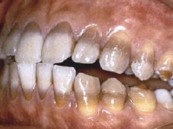 <p>What is this condition?</p>