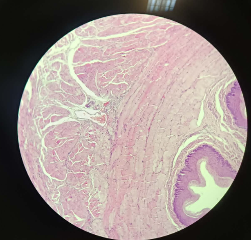 <p>Esophagus Stratified Squamous nonkeratinized - HE (18)</p><ul><li><p>Membrane invaginations (wrinkling)</p></li><li><p>all of the cells are alive and has nuclei</p></li><li><p>stratified squamous nonkeratinized epithelium</p></li></ul><p></p><p>Top of basal membrane - layer of small cells (stratum germinativum<strong> </strong>/ stratum basale); small cylindrical shaped</p><p>On top, bigger cells - Polygonal shaped</p><p>On top, flat cells - squamous epithelium cells</p><p></p><ol><li><p>Tunica Mucosa<br>a. Lamina Epitheliaris<br>b. Lamina Propria - may see some glands<br></p></li><li><p>Tela submucosa - big glands (esophageal glands, glandula esophage)</p></li><li><p>Tunica Muscularis</p></li><li><p>Tunica Adventitia</p></li></ol><p></p>