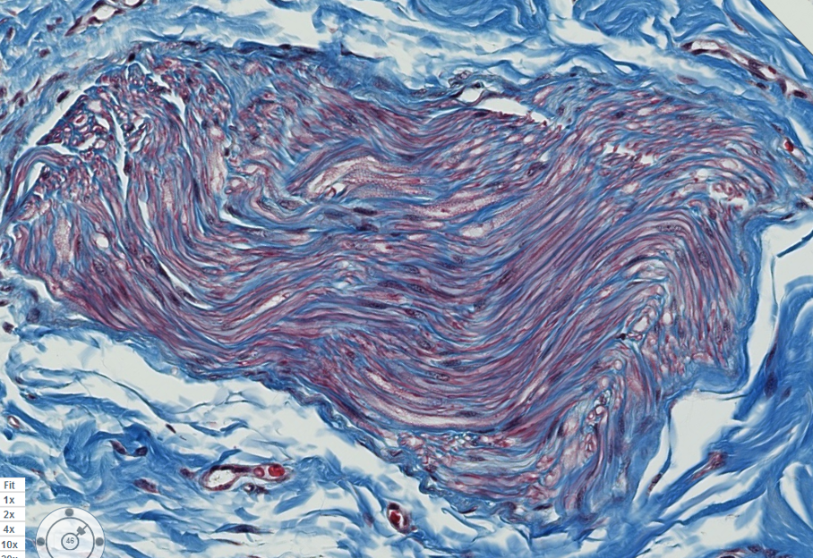 <p><span style="font-family: "Calibri Light";">Is this nerve fascicle myelinated or unmyelinated?</span></p>