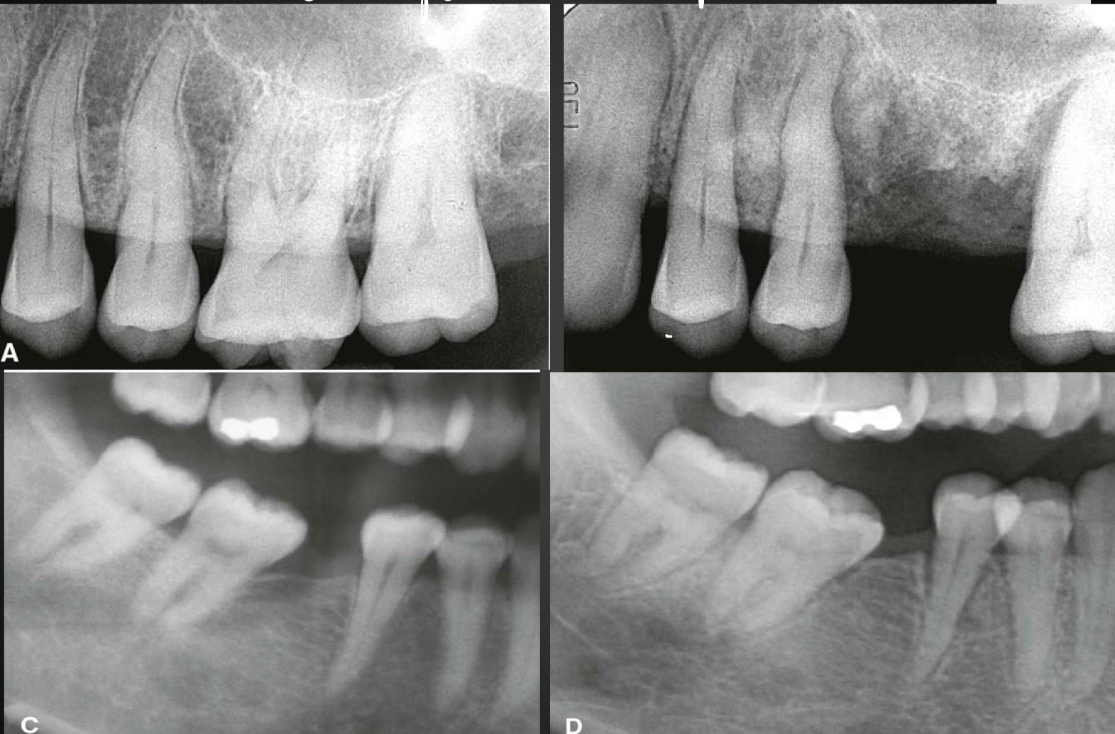 <p>the two images on the left show…. while the two images on the right show…</p>