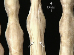 <p>In this anterior view of the right hand, identify the muscle whose tendon is indicated by the arrows.</p>