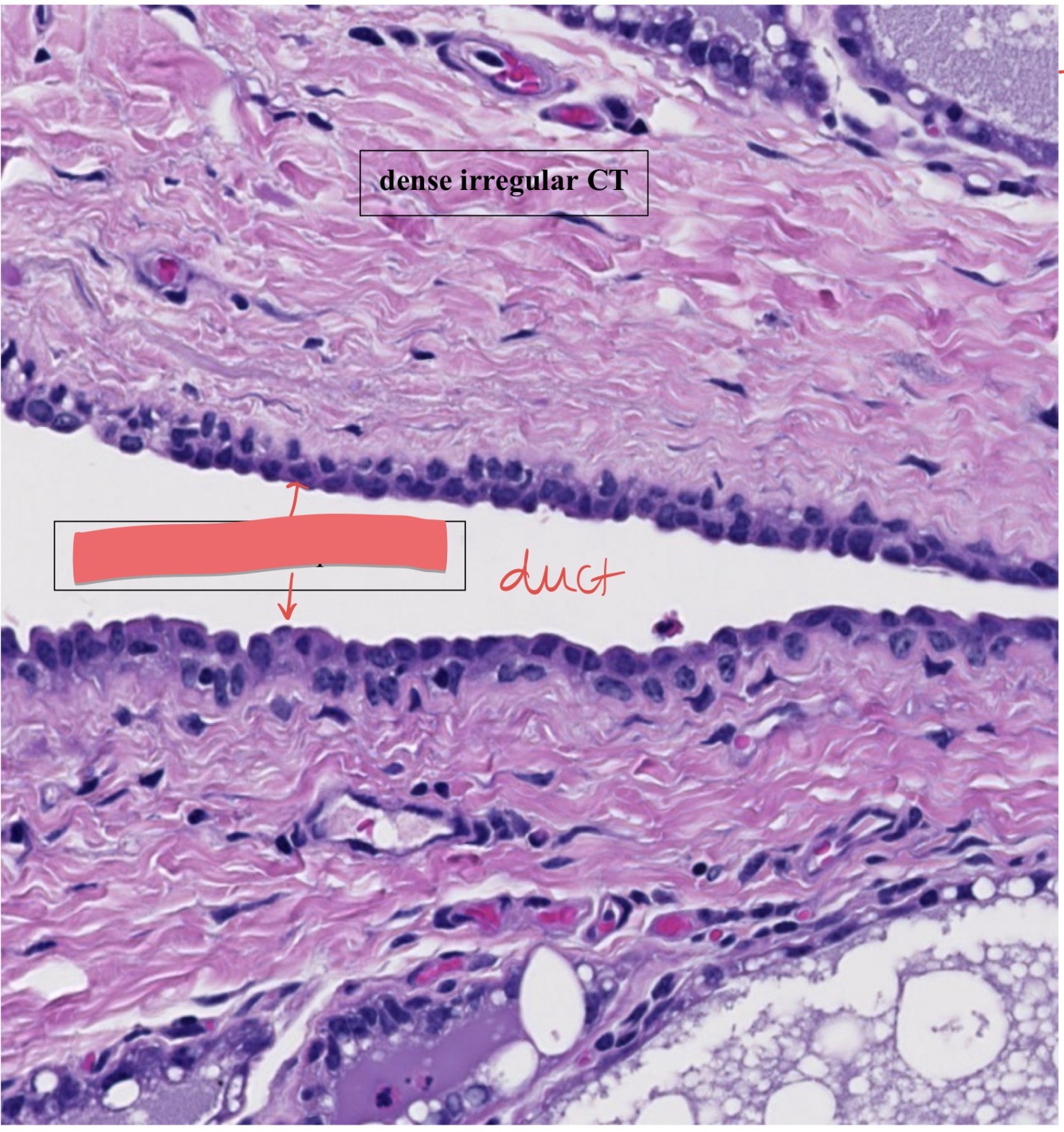 term image