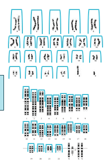 <ul><li><p>Pairs of the same chromosome</p></li><li><p>One maternal, one paternal</p></li></ul><p></p>