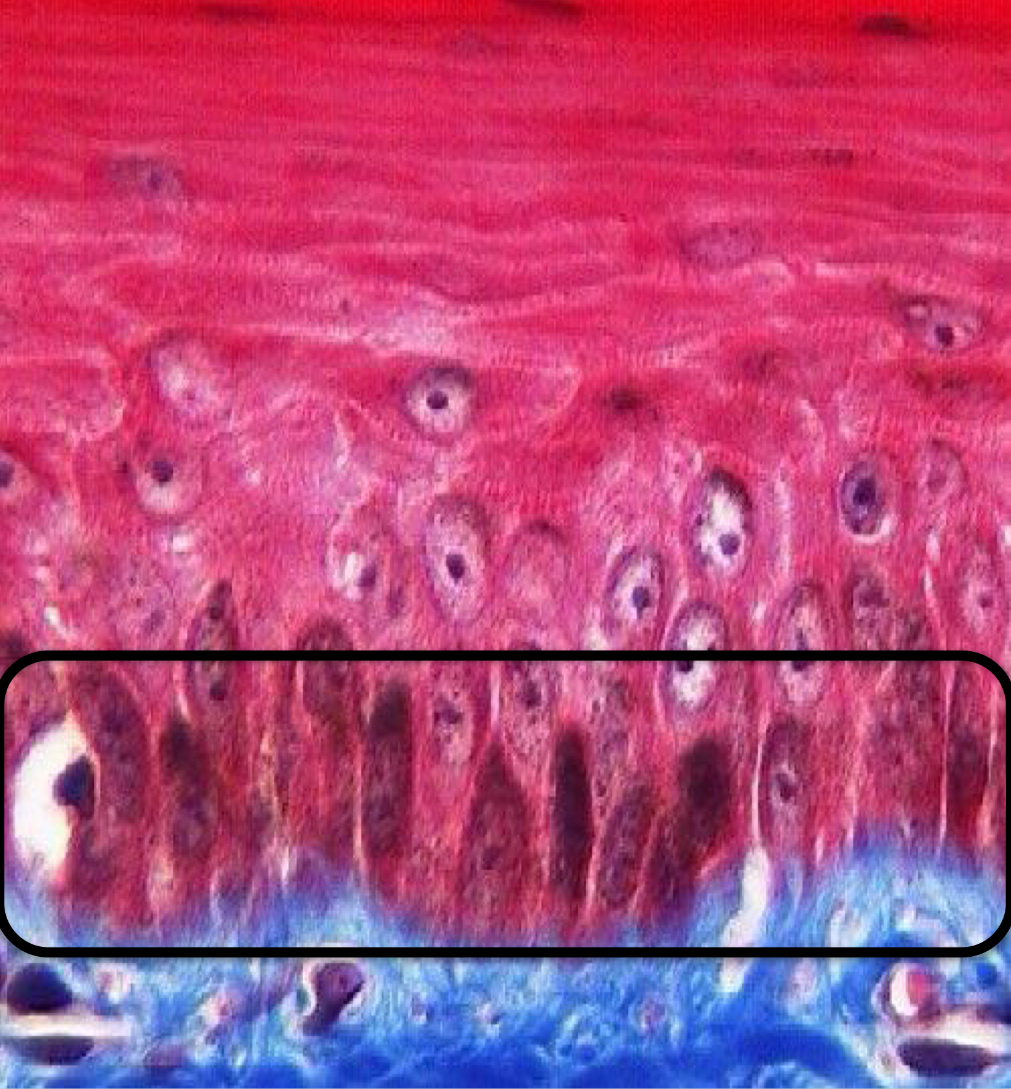 <p>What layer of the epidermis is this?</p>