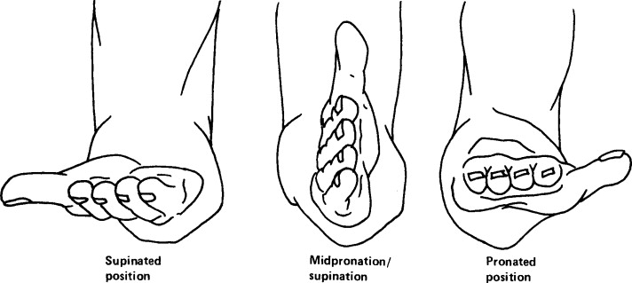 <p>turning the palm anteriorly</p>