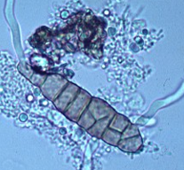 term image