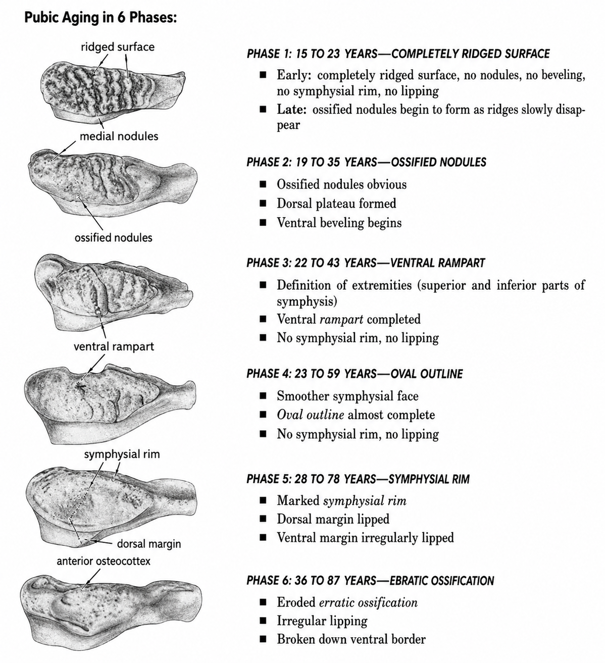 <p>Phases:</p><ul><li><p><u>Phase 1 (15-23)</u>: Ridged surface, no beveling, no symphysis rim, no lipping</p></li><li><p><u>Phase 2 (19-35)</u>: Nodules and beveling, ventral beveling begins</p></li><li><p><u>Phase 3 (22-43)</u>: Ventral rampart complete, no rim, no lipping</p></li><li><p><u>Phase 4 (23-59)</u>: Smooth face, oval outline almost complete, no rim, no lipping</p></li><li><p><u>Phase 5 (28-78</u>): marked rim and lipping,</p></li><li><p><u>Phase 6 (36-87)</u>: erratic ossification, irregular lipping</p></li></ul><p></p><p>Best method for adult age estimation</p><p>Changes in billowing, boarder, face shape, etc.</p><p></p>