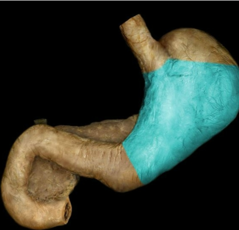 term image