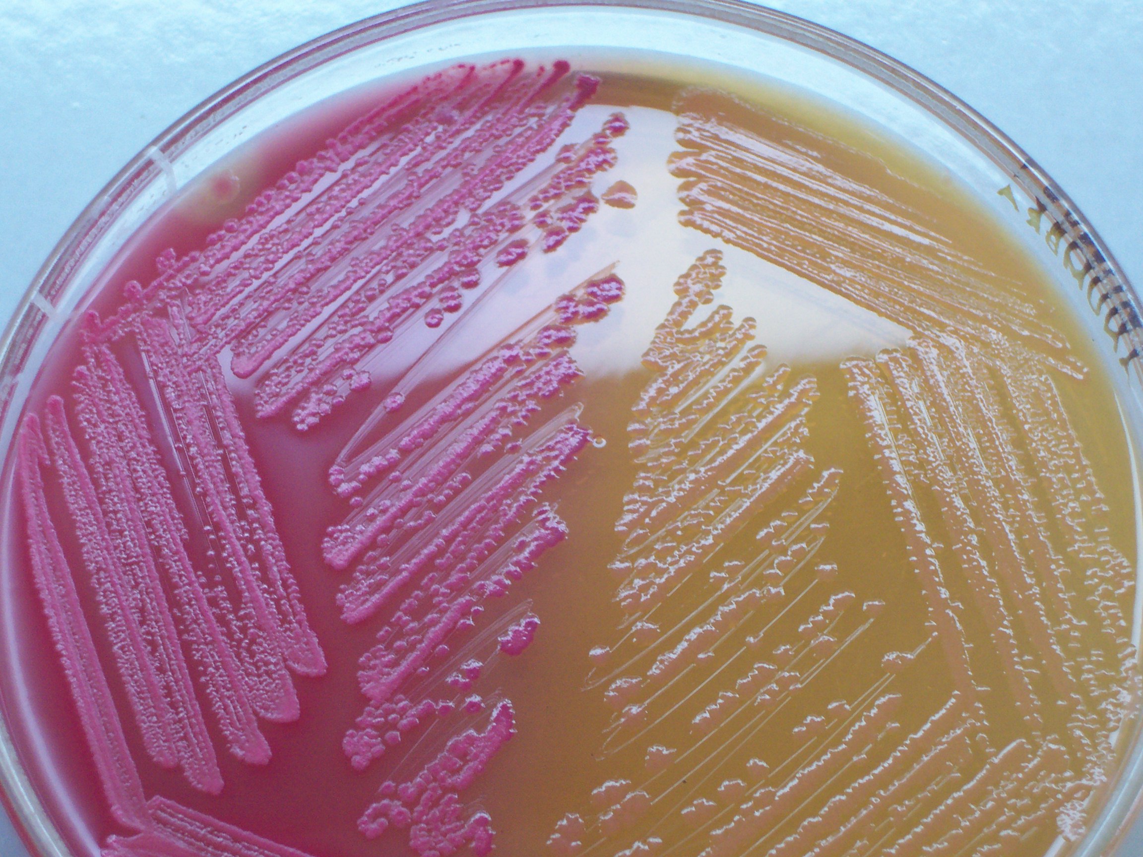 <p>In the MacConkey agar, what does the pink side indicate? </p>