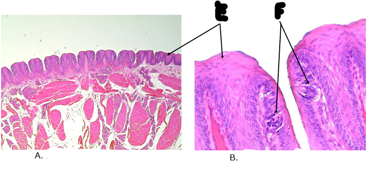 <p>what gland is this? </p>