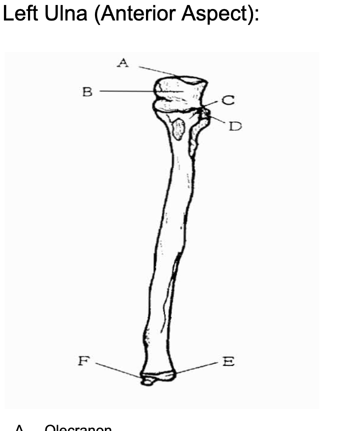 <p>C</p>