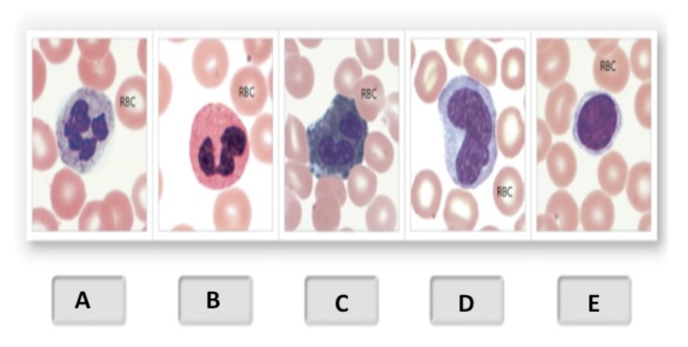 <p>Which white blood cell is neurophil </p>