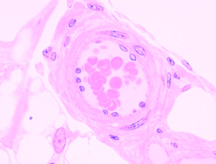 <p>What type of artery is shown?</p>