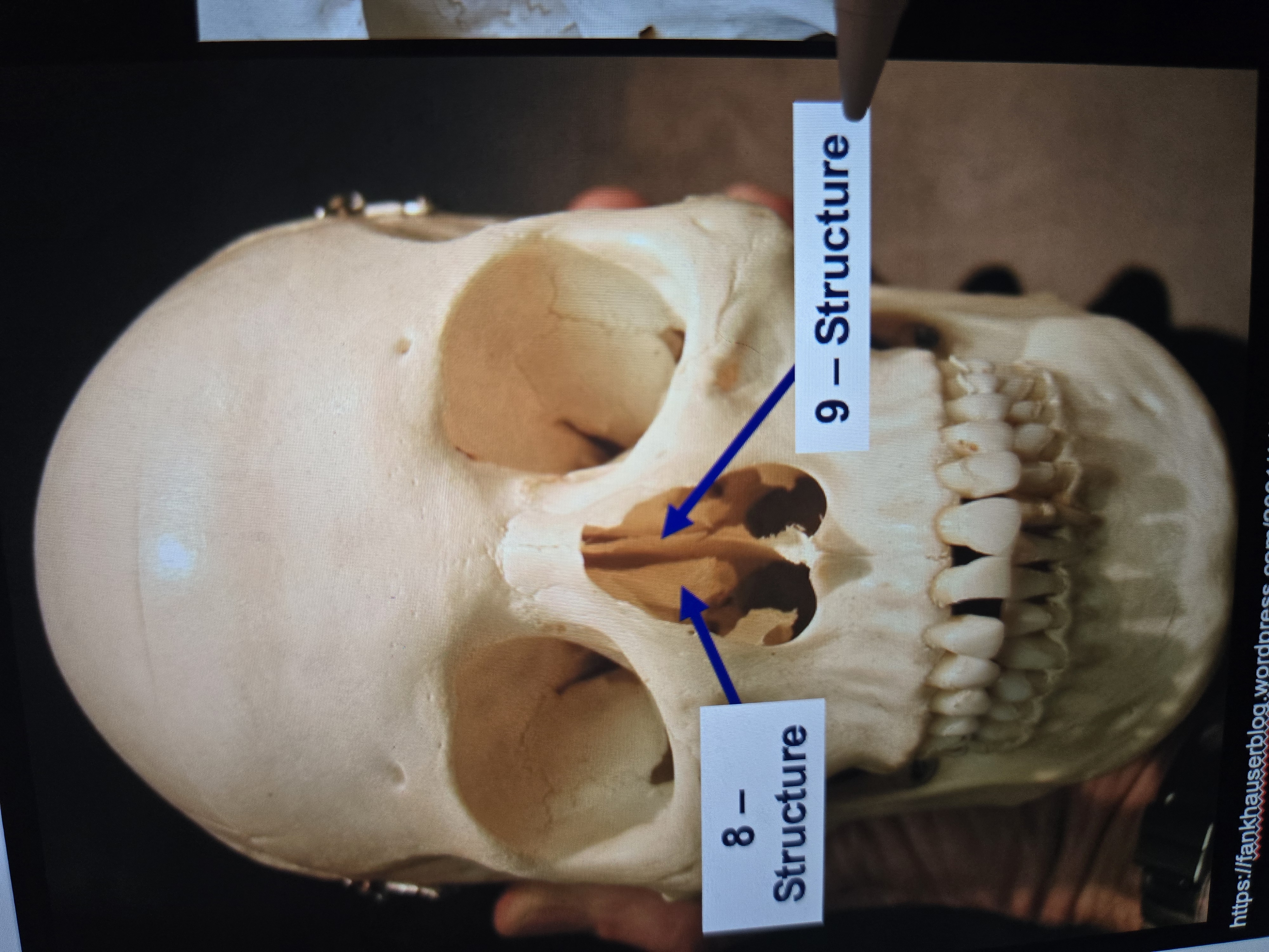 <p>(ethmoid)</p>