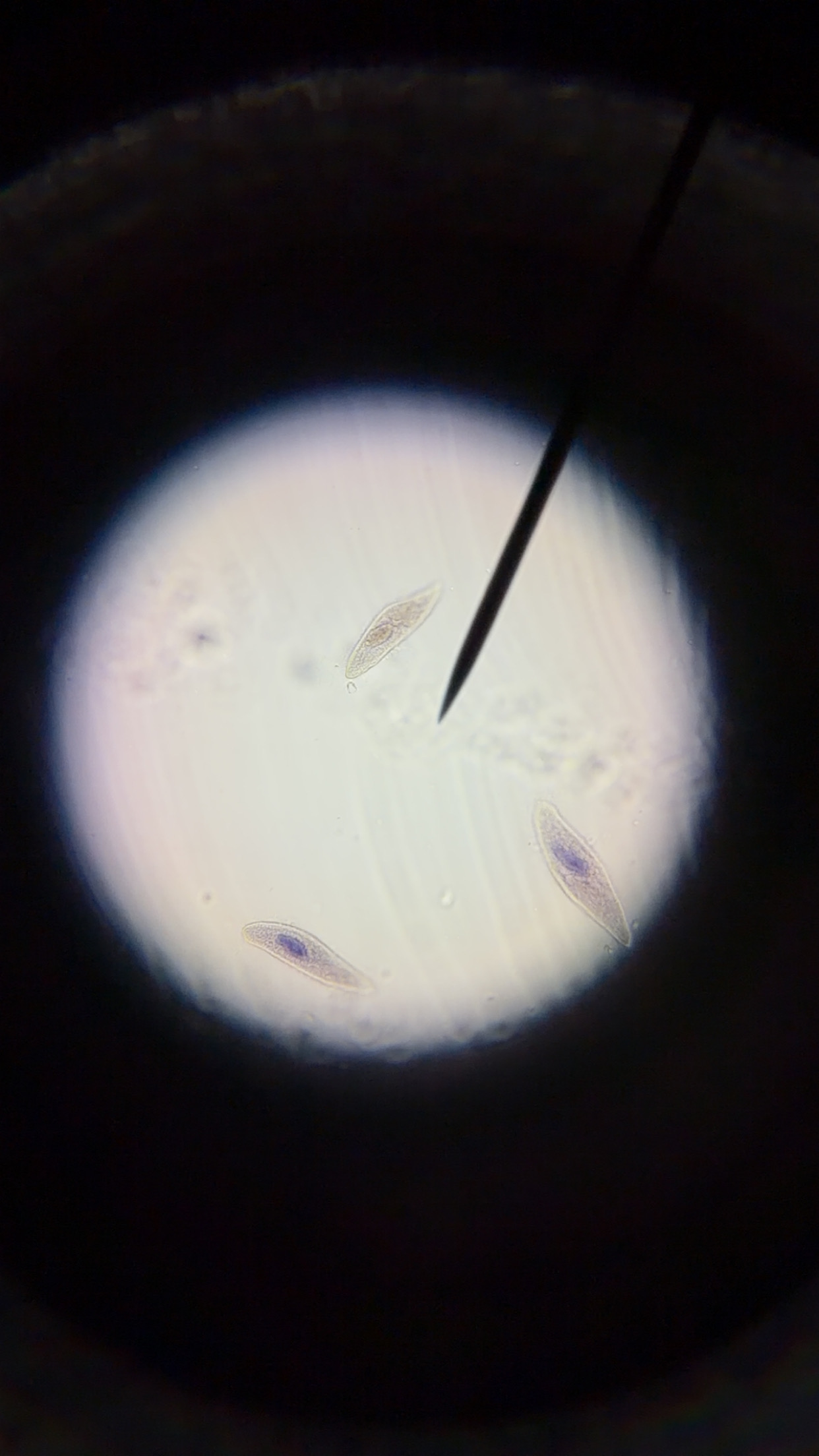 <ol><li><p>This slide shows a/an:</p></li></ol><p class="p1">a) Prokaryotic cell</p><p class="p1">b) Eukaryotic cell</p><p class="p1">c) None of the above</p><ol start="2"><li><p class="p1">Which type of cells does this slide show?</p><p class="p1">a) Cocci cells</p><p class="p1">b) Bacilli cells</p><p class="p1">c) Spirilli cells</p><p class="p1">d) None of the above</p></li></ol><ol start="3"><li><p class="p1">Which type of cell does this slide show an example of:</p></li></ol><p class="p1">a) Spirogyra</p><p class="p1">b) Volvox</p><p class="p1">c) Diatoms</p><p class="p1">d) None of the above</p><ol start="4"><li><p class="p1">Which type of cell does this slide show an example of:</p><p class="p1">a) Amoeba</p><p class="p1">b) Paramecium</p><p class="p1">c) None of the above</p></li><li><p class="p1">Which type of cell does this slide show an example of:</p><p class="p1">a) Archaebacteria or Eubacteria</p><p class="p1">b) Plantae</p><p class="p1">c) Protista</p><p class="p1">d) Fungi</p><p class="p1">e) Animalia</p></li></ol><p class="p1"></p><p class="p1"></p>