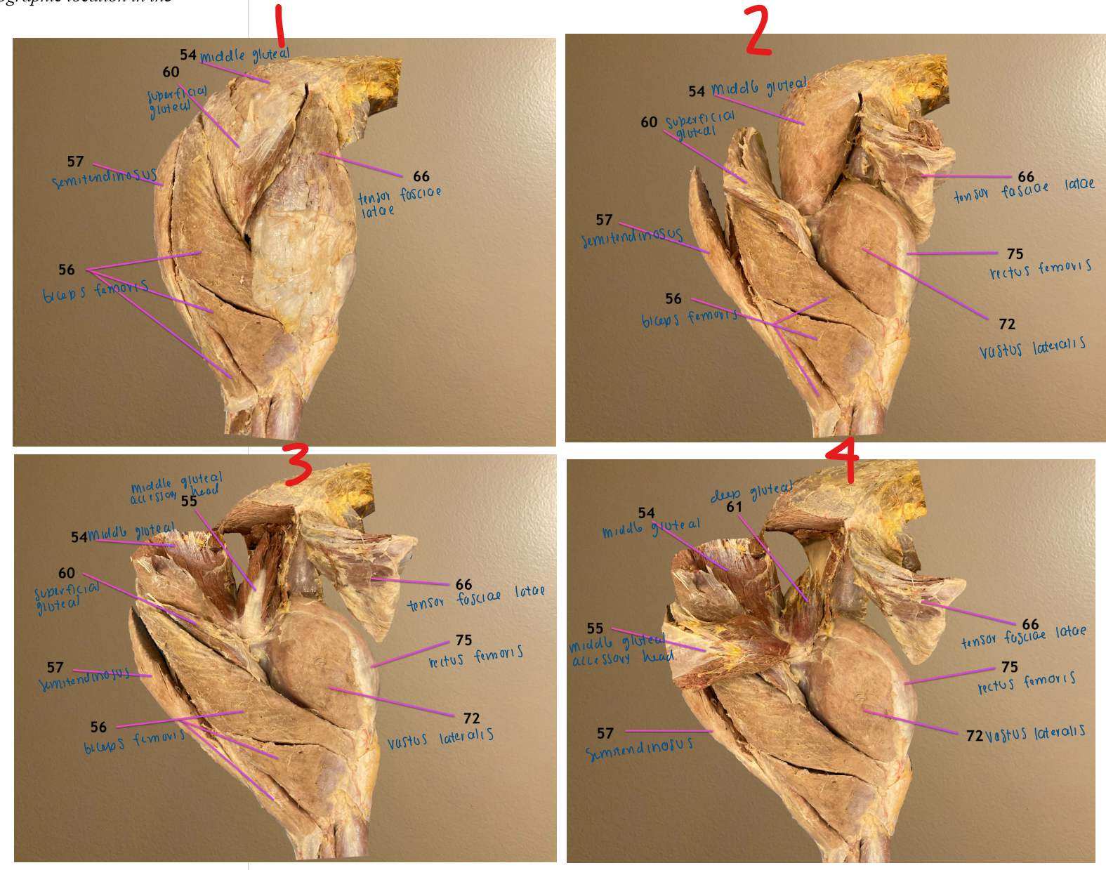 <ol start="54"><li><p>middle gluteal m.</p></li><li><p>middle gluteal accessory head</p></li><li><p>biceps femoris m.</p></li><li><p>semitendinosus</p></li></ol><p>.</p><p><em>note: all are hip extensors</em></p>