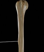 <p>Rounded projection</p>