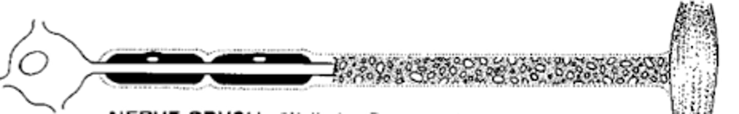 <p>-Injury to axon & myelin but supporting connective tissue is intact</p><p>-Conduction block</p>