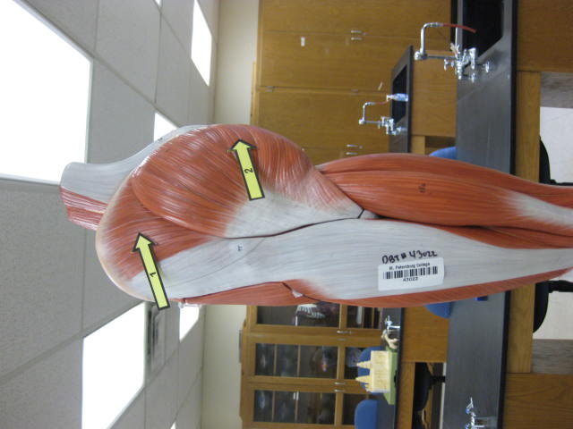 <p>What is at #2?</p>