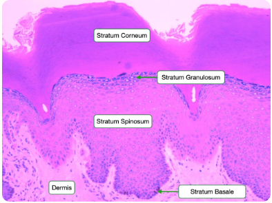 <p>Which layer is the thickest layer? (Hint: cell shape looks like spines)</p>