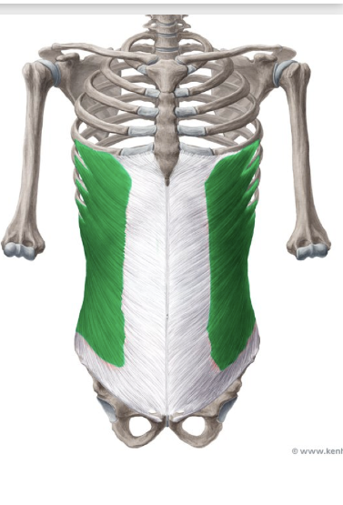 <p>what structure is depicted in green?</p>