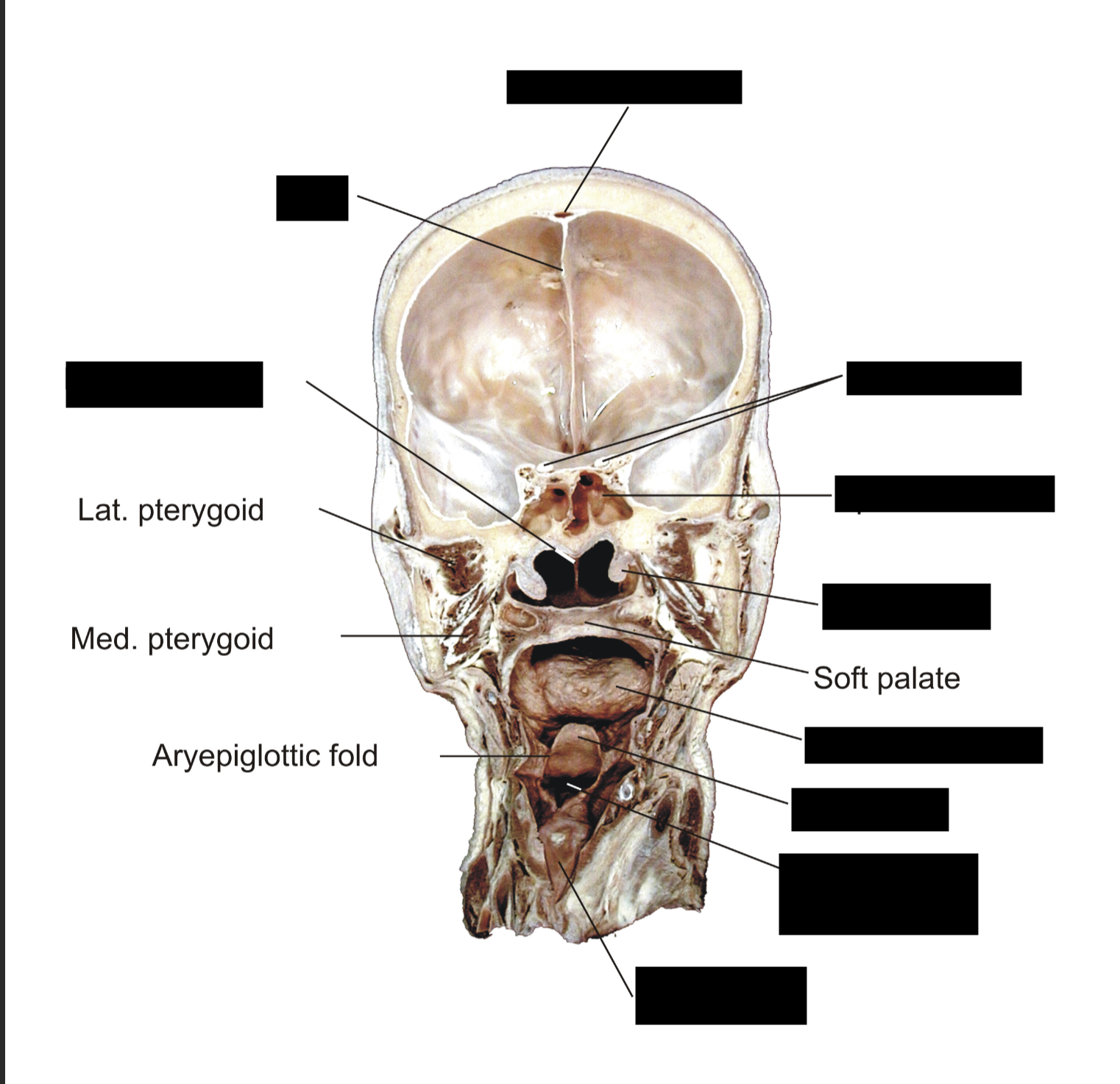 term image