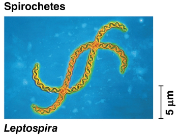 <p>Spirochetes</p>