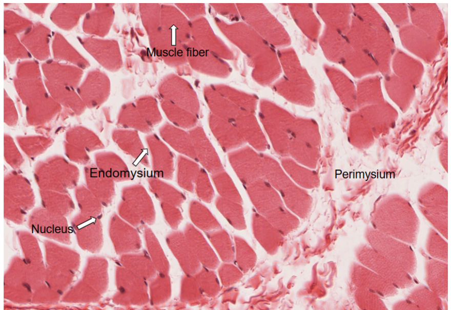 <p>Endomysium</p><p>Perimysium</p><p>Muscle fiber</p><p>Peripherally located nuclei</p>