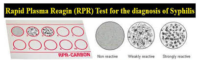 <p>Flocculation (Precipitation) (Non-Treponemal Test)</p>