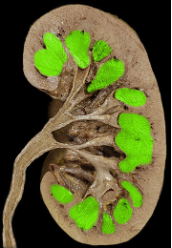 <p>renal pyramids</p>