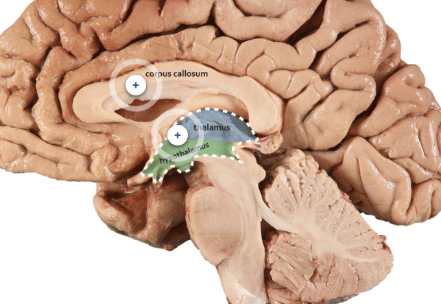 <p></p><p>USES →</p><ul><li><p>regulates endocrine functions w hormone release</p></li><li><p>regulate homeostasis systems </p><ul><li><p>temp</p></li><li><p>body water </p></li><li><p>hunger/ food intake</p></li><li><p>cardiovascular </p></li><li><p>circadian clock </p></li><li><p>emotions  </p></li><li><p>thirst</p></li></ul></li></ul><p></p><p>ANATOMY →</p><ul><li><p><u>base of brain, anterior brain stem, under thalamus </u></p></li><li><p><u>use negative feedback system </u></p><ul><li><p>stimuli trigger homeostasis change</p></li><li><p>sensor see info</p></li><li><p>control center sends info → </p><ul><li><p>effector</p></li><li><p> mechanism (effector also uses this to send info back to stimuli integration center to regulate signaling)</p></li></ul></li></ul></li></ul><p></p>