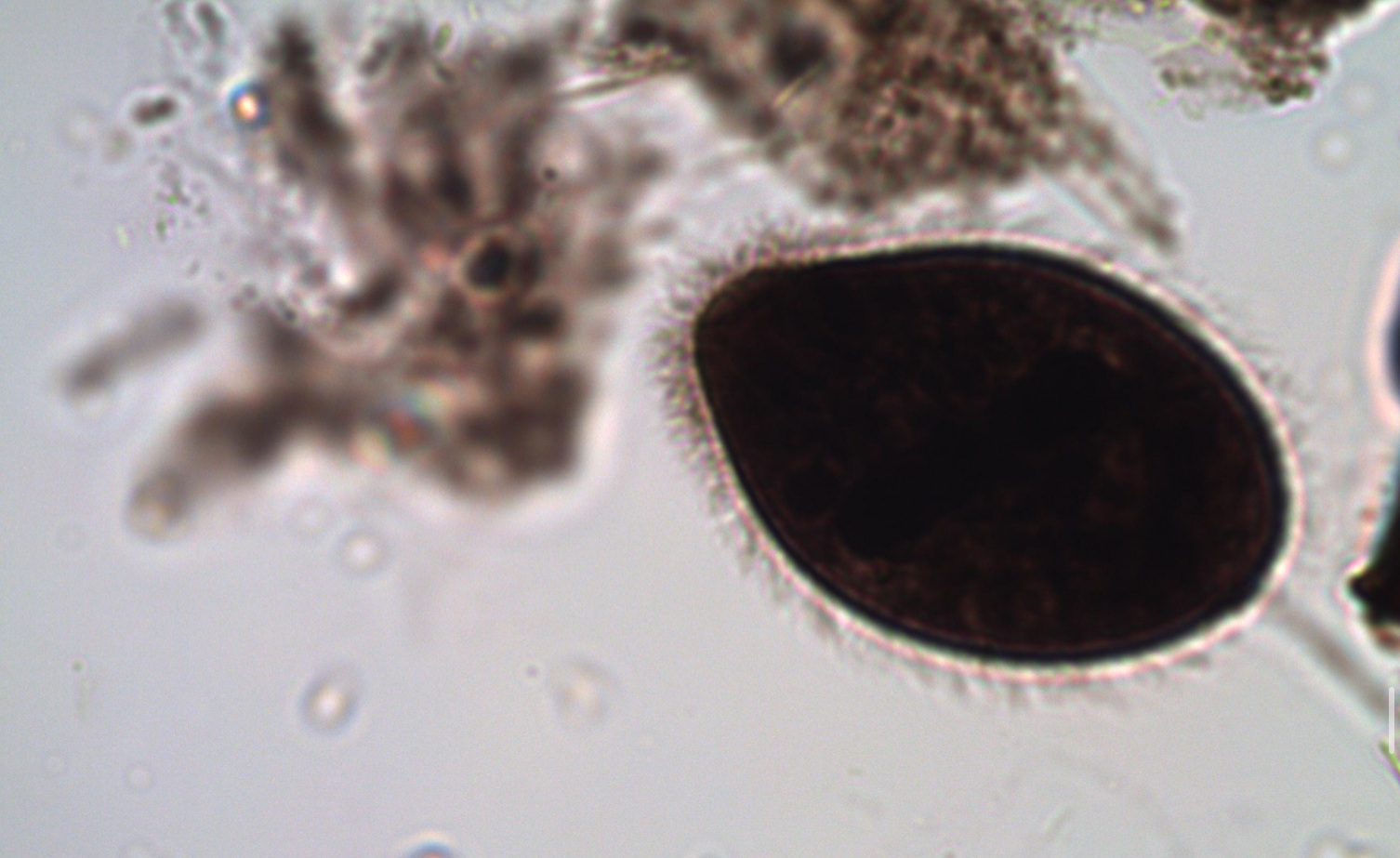 <p>*note cilia </p>