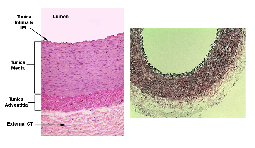 <p>A large lumen and a thick layer of smooth muscle (tunica media) and connective tissue (tunica adventitia)</p>