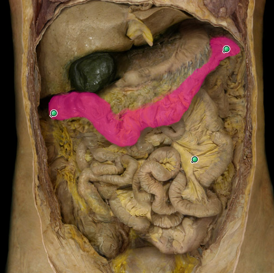 <p>what organ is this?</p>