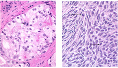 <p>What can be seen as indicated by the arrows in these two slides?</p>