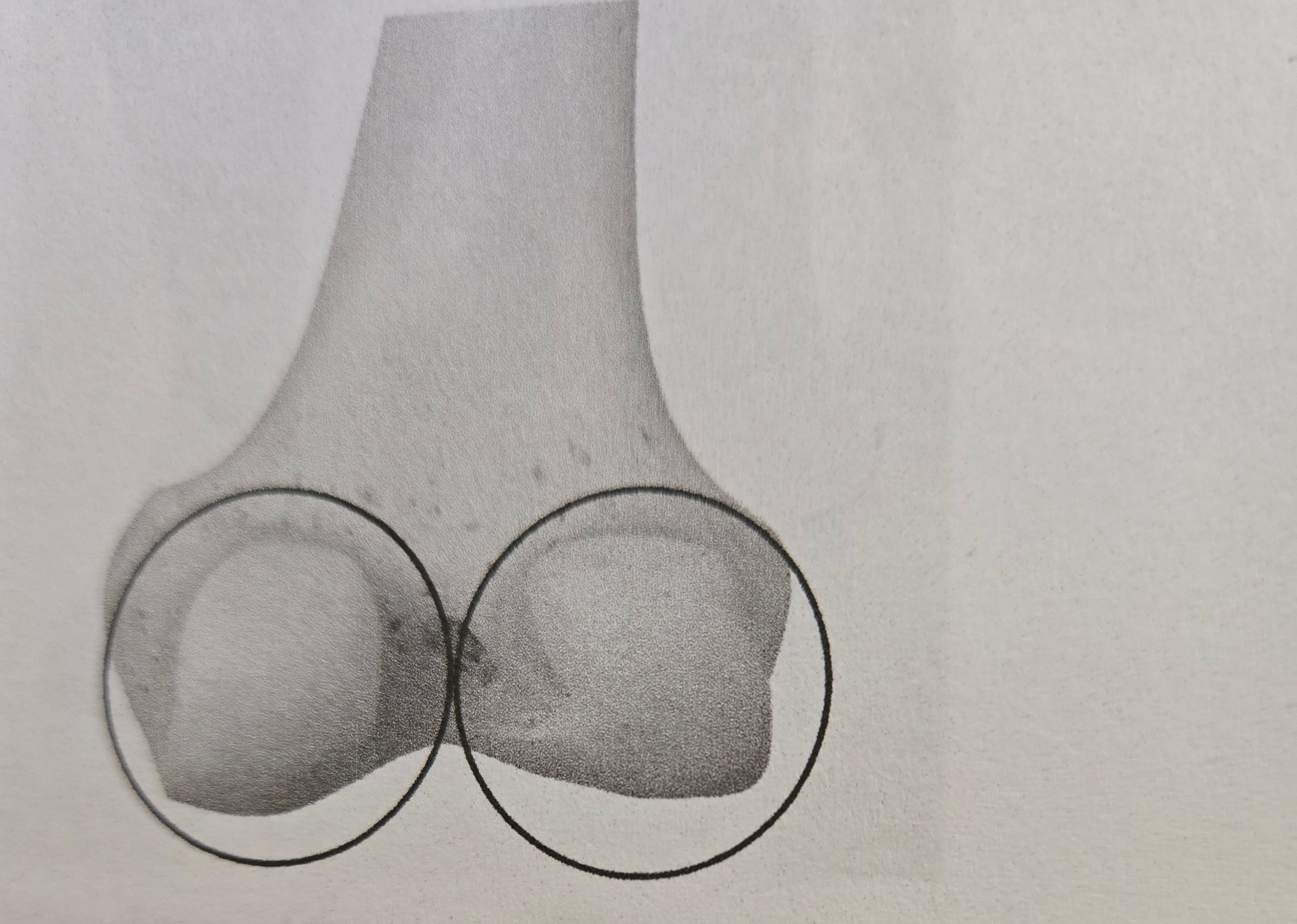 <p>Condyle</p>