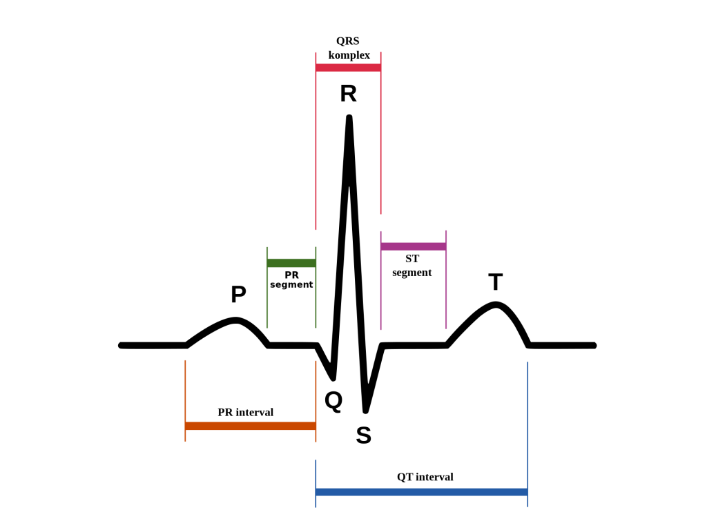 <ul><li><p><span><strong>P wave:</strong> Atrial depolarization (activation/contraction of the upper chambers).</span></p></li><li><p><span><strong>PR Interval:</strong> Time for impulses to travel from the atria to the ventricles.</span></p></li><li><p><span><strong>QRS Complex:</strong> Ventricular depolarization (contraction/pumping of the lower chambers).</span></p></li><li><p><span><strong>ST Segment:</strong> Time between ventricular contraction and relaxation.</span></p></li><li><p><span><strong>T wave:</strong> Ventricular repolarization (recovery/relaxation of the ventricles).</span></p></li></ul><p></p>