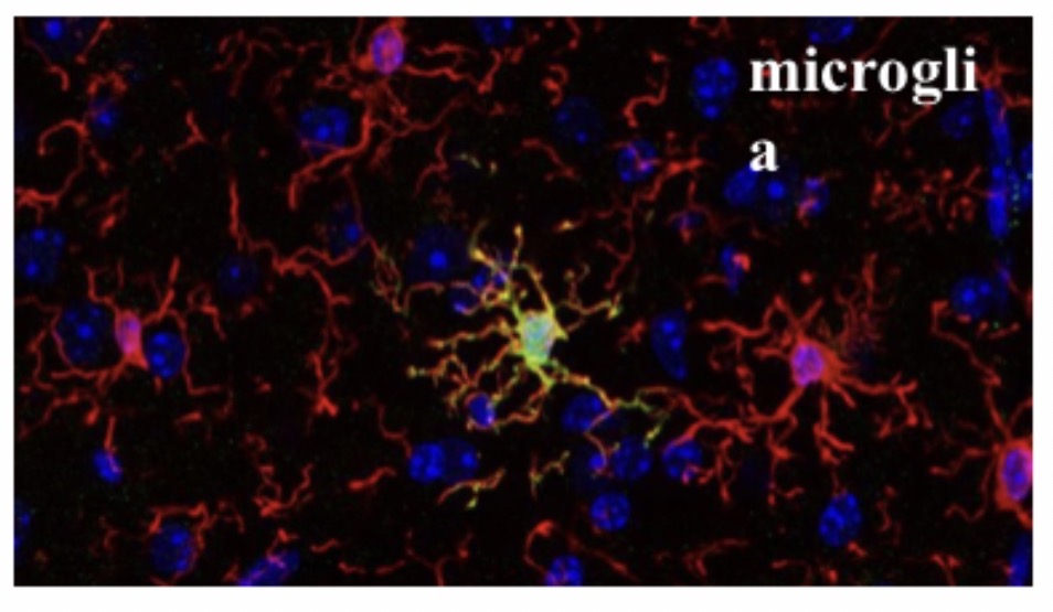 <p>Microglia </p>