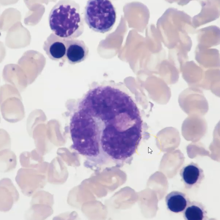 <p>M7 - megakaryocytic </p>