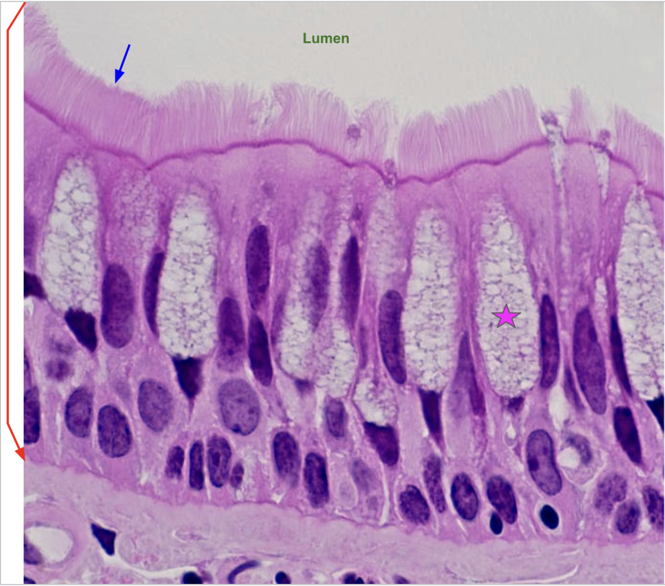 <p>The mucosa of the trachea</p><p>Red: Pseudostratified ciliated columnar epithelium.</p><p>Blue: Cilia</p><p>Star: Goblet cells - make mucus</p>