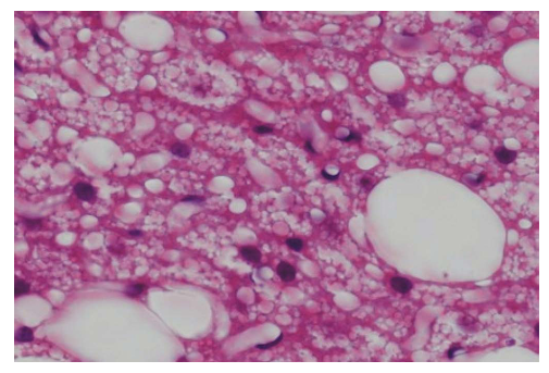 <p><strong>A14) What is the main classification of tissue (be specific) that can be observed in this specimen?</strong></p>