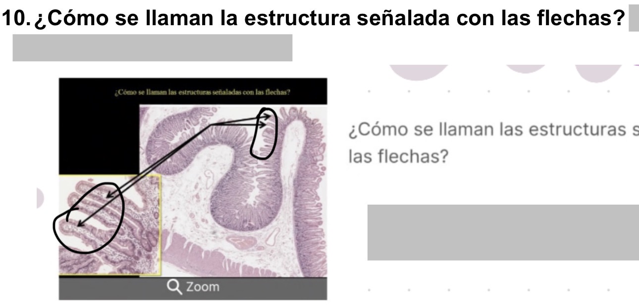 <p>vellosidades intestinales </p>