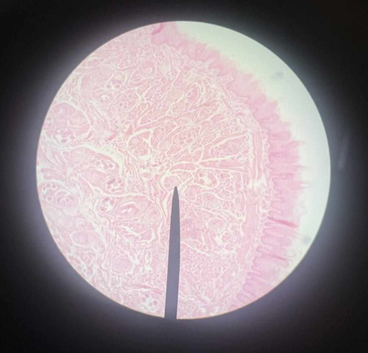 <p>subkingdom eumetaoza</p><p>phylum nematoda</p><p>larvae, muscle, cyst</p>