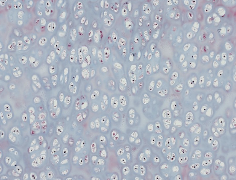 <p>Which basic type of CT is this? be specific.</p>