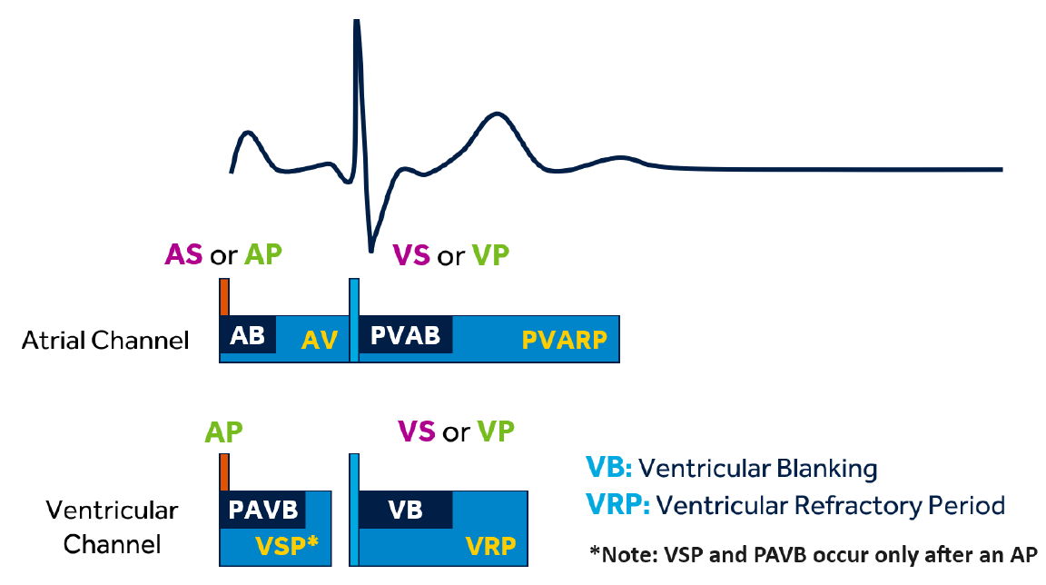 <p>This interval is triggered by a ventricular sensed (VS) or ventricular paced (VP) event. </p><p>The ventricular refractory period helps prevent oversensing of the same ventricular event</p>