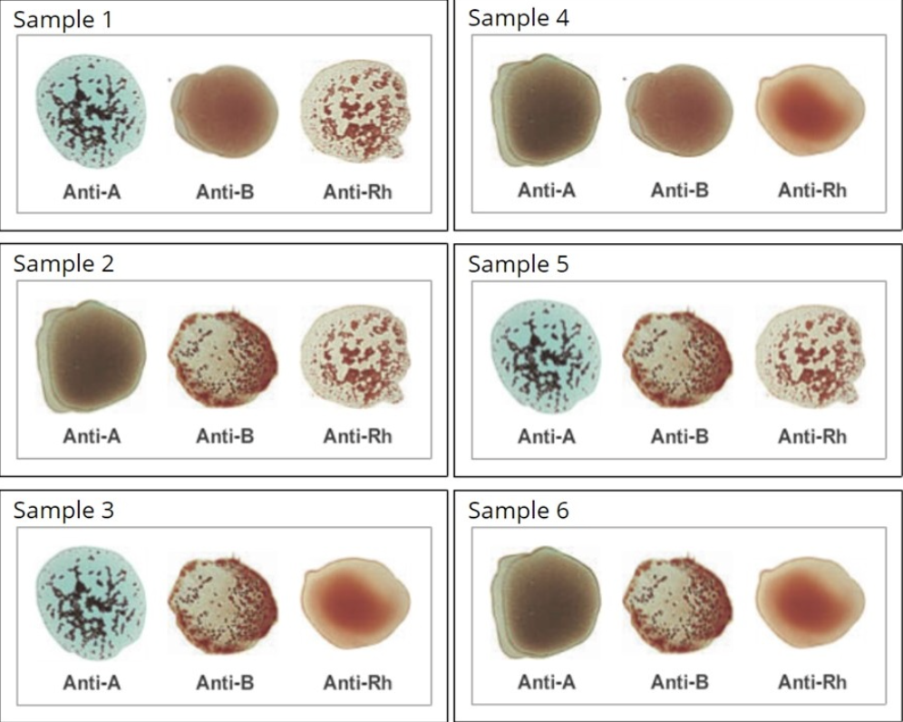 <p>Sample 1 is</p>